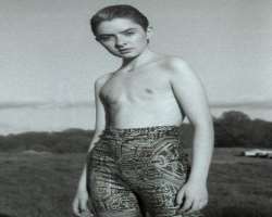 Lachlan Watson before surgery